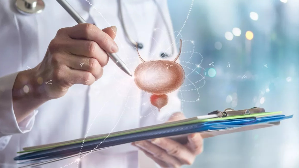 Αιματουρία: Ένας στους πέντε ασθενείς με αίμα στα ούρα θα εμφανίσει καρκίνο ουροδόχου κύστης