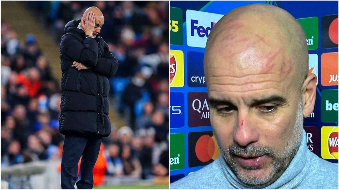 Χαμός στα social media για τις πληγές στο πρόσωπο του Γκουαρδιόλα, τι εξήγηση έδωσε ο ίδιος