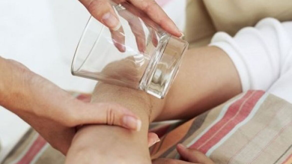 Βακτηριακή μηνιγγίτιδα ή Μηνιγγιτιδόκοκκός: Αίτια, συμπτώματα, θεραπεία