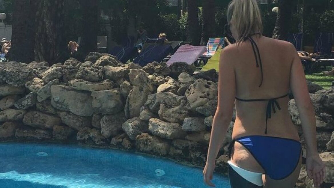 Έχασε το πόδι της και τώρα δίνει έμπνευση σε ανθρώπους χωρίς αυτοπεποίθηση (pics)