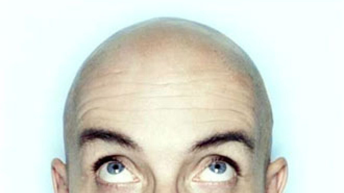 Είσαι καραφλός; Θα πας μπροστά! 