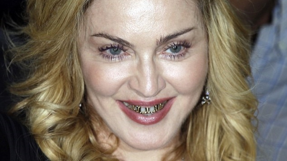 Εδειξε τα χρυσά της δόντια η Μαντόνα