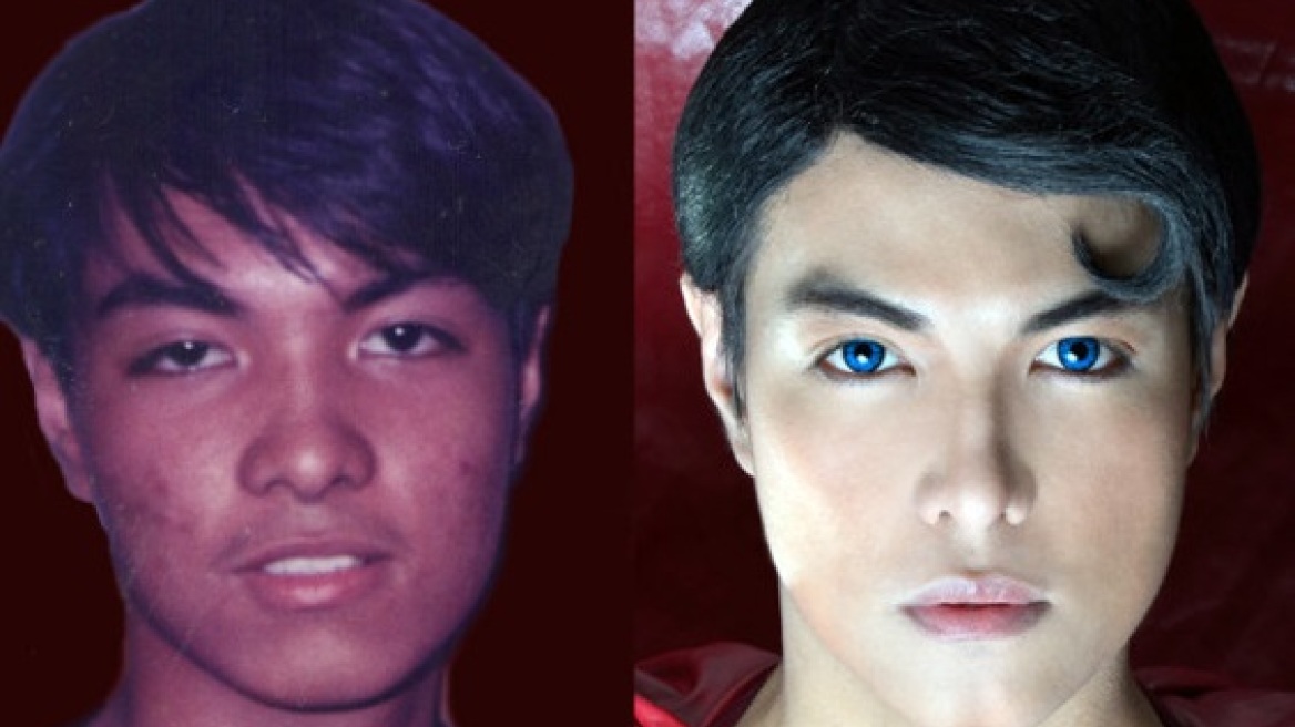 Φιλιππίνες: Έκανε 19 πλαστικές για να μοιάσει στον... Σούπερμαν