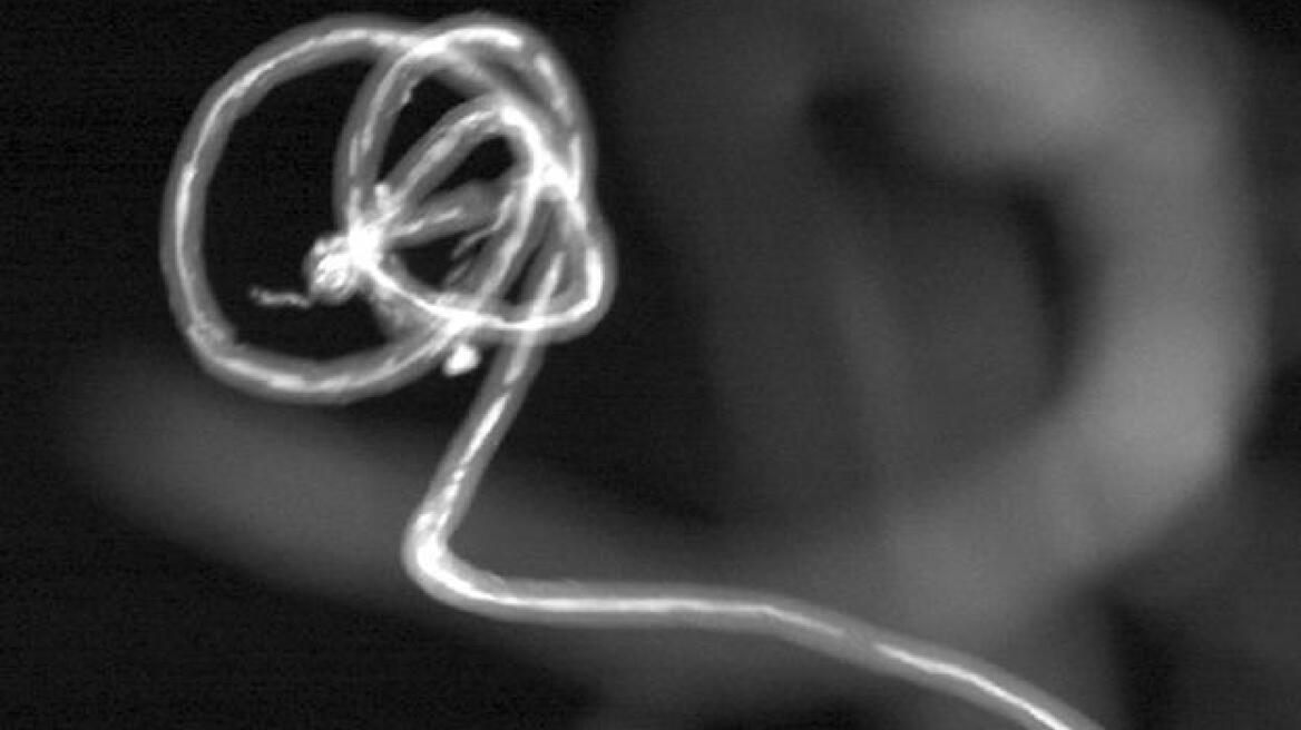 Δημιούργησαν θερμόμετρο-τατουάζ!