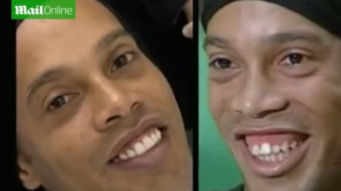 Ο Ροναλτίνιο έφτιαξε τα... δόντια του