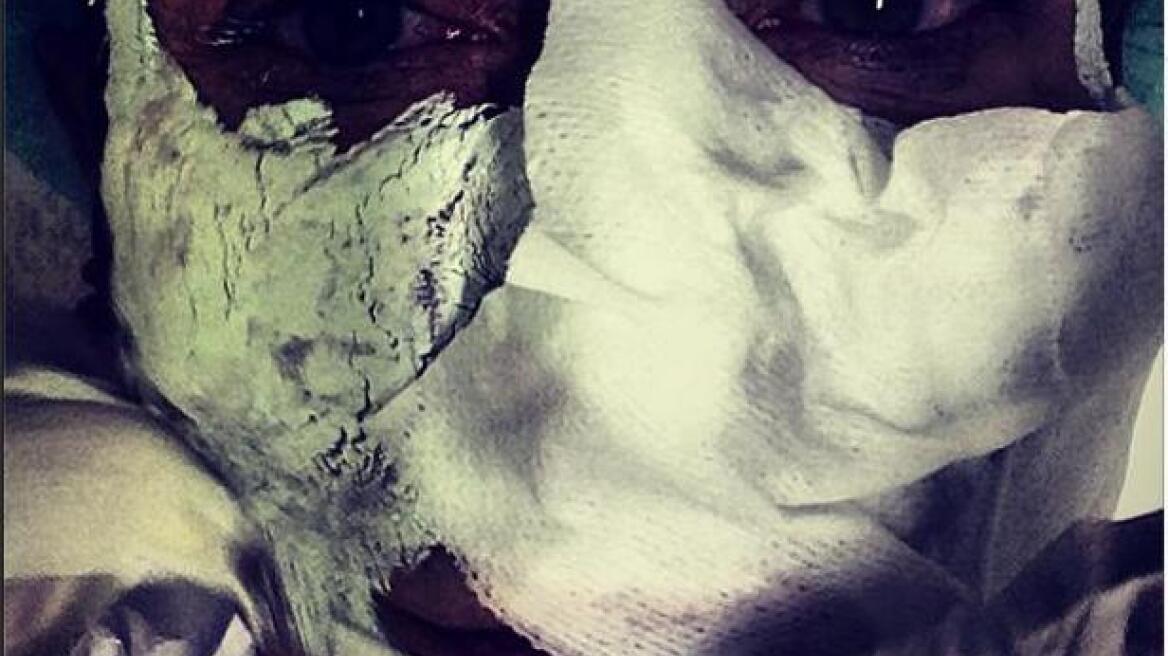 Ο Βασίλειος Κωστέτσος στη λωρίδα της… γάζας