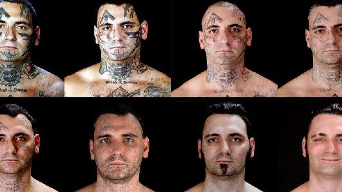 Μετανιωμένος ρατσιστής αφαιρεί όλα τα ναζιστικά τατουάζ του!