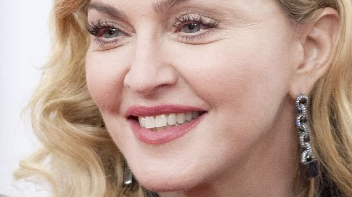 Madonna: Τι έκανε (ξανά) στο πρόσωπό της;