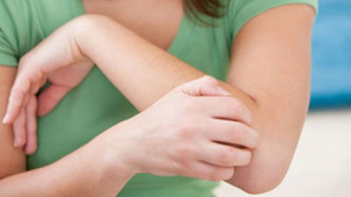  Τι μας προκαλεί φαγούρα 