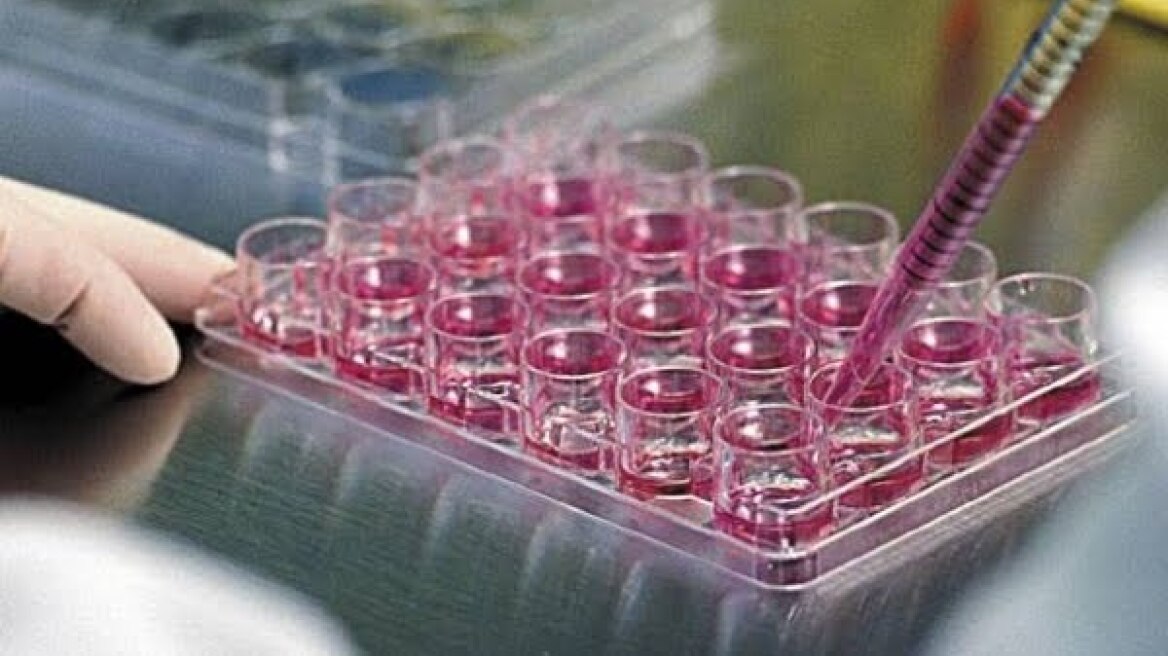 Σημαντικές εξελίξεις στη θεραπεία καρκίνων του αίματος με βλαστοκύτταρα 