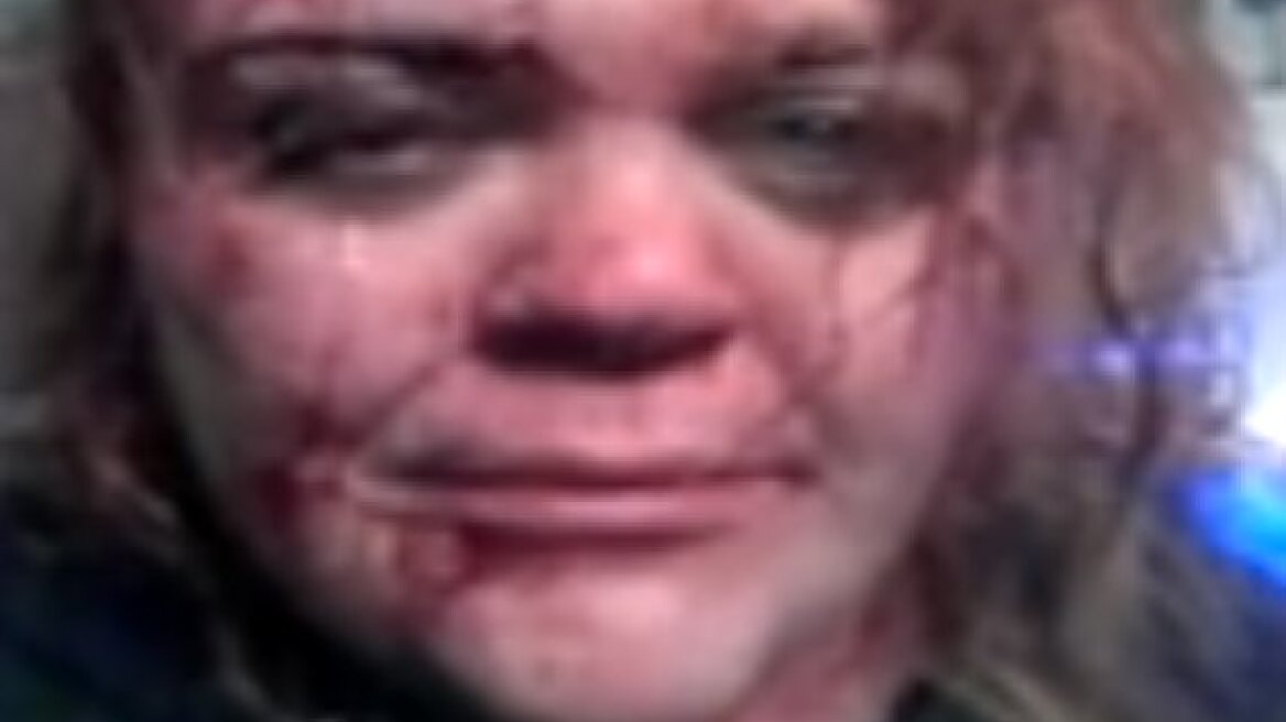 Το ματωμένο selfie της έσωσε τη ζωή!