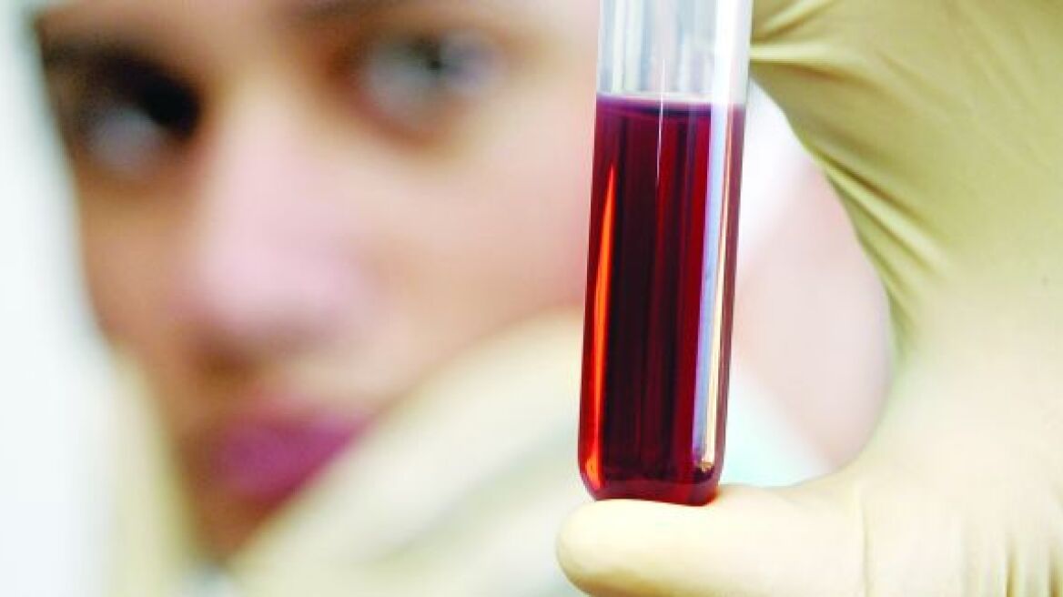 Επιστήμονες έφτιαξαν τεχνητό αίμα – Τι σημαίνει αυτό για την υγεία;