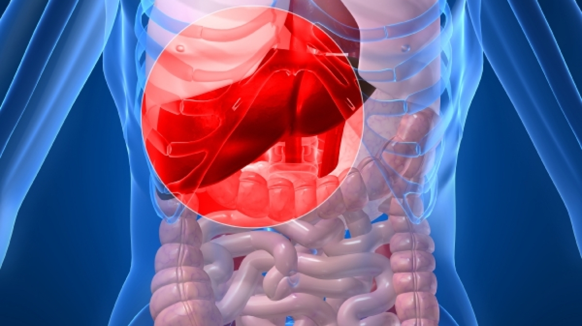 Πειραματική θεραπεία κατά της ηπατίτιδας C θεράπευσε το 90% των ασθενών!