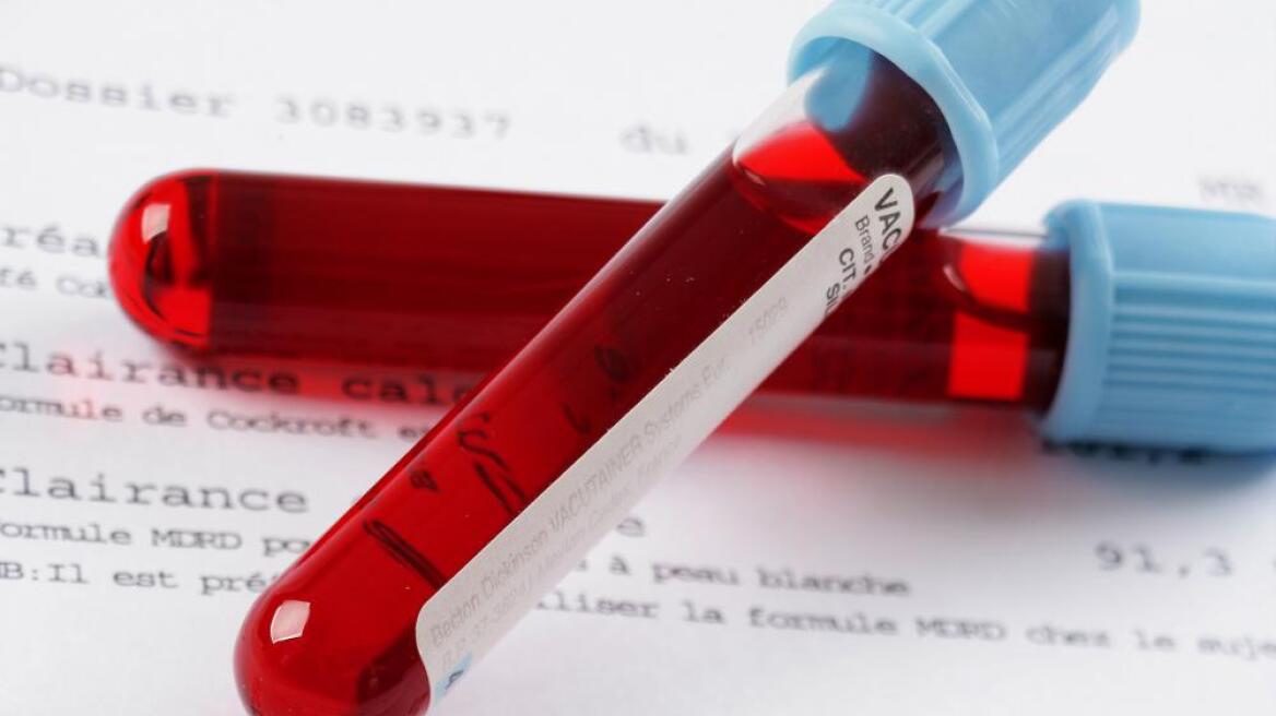 Ανακάλυψη: Βρέθηκε το ελιξίριο νεότητας και είναι...