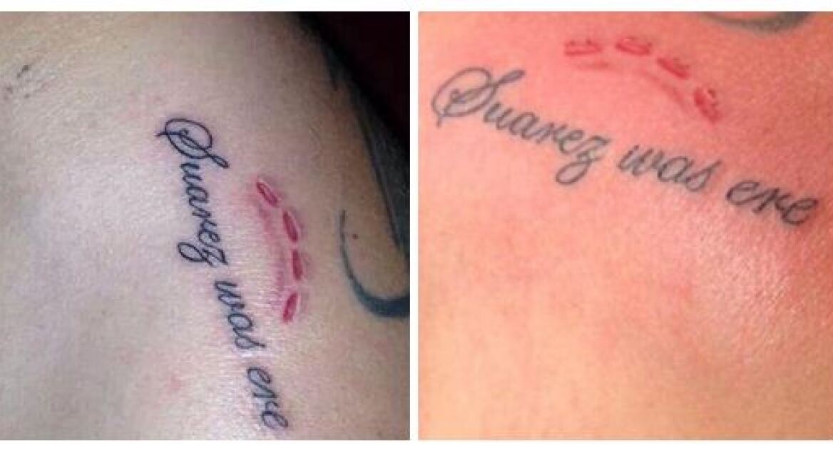 Φωτογραφίες: Έκανε τατουάζ το δάγκωμα του Σουάρες στον Κιελίνι
