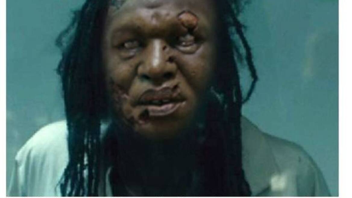 Κακόγουστη φάρσα τα «ζόμπι του Έμπολα» - Δείτε φωτογραφία που σοκάρει... 