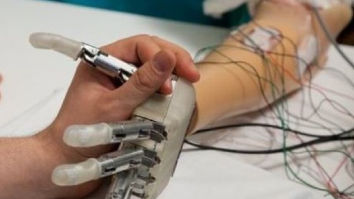 Προσθετικό χέρι με ρεαλιστική αίσθηση αφής για πρώτη φορά