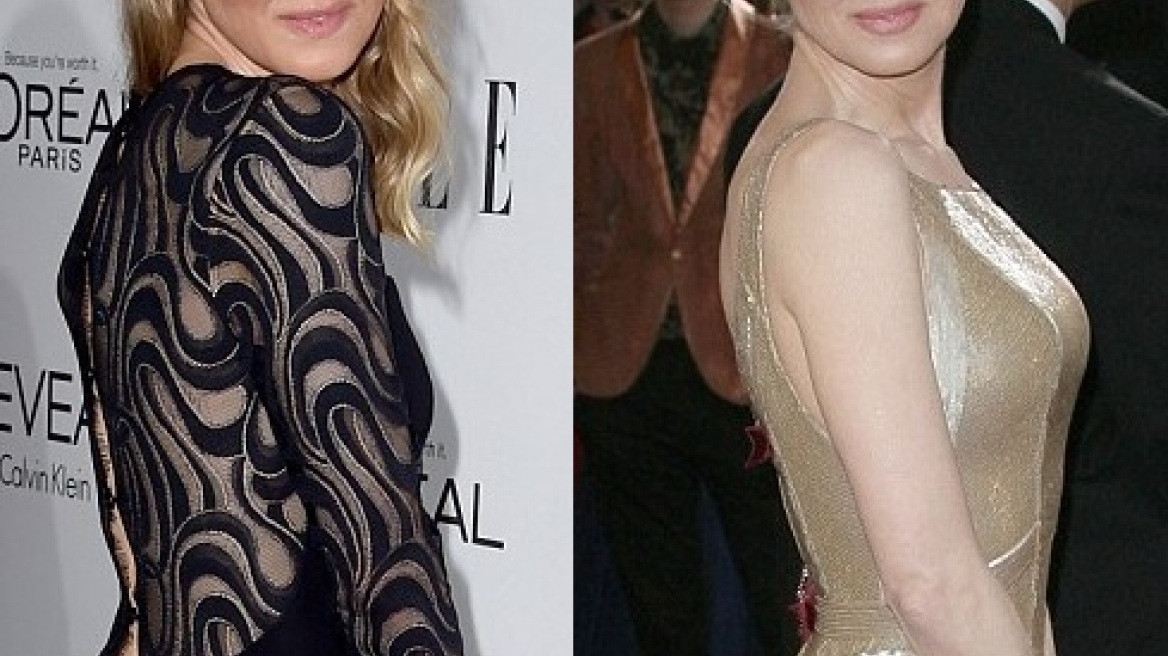 Ρενέ Ζελβέγκερ: Μα τι έκανε στο πρόσωπό της;