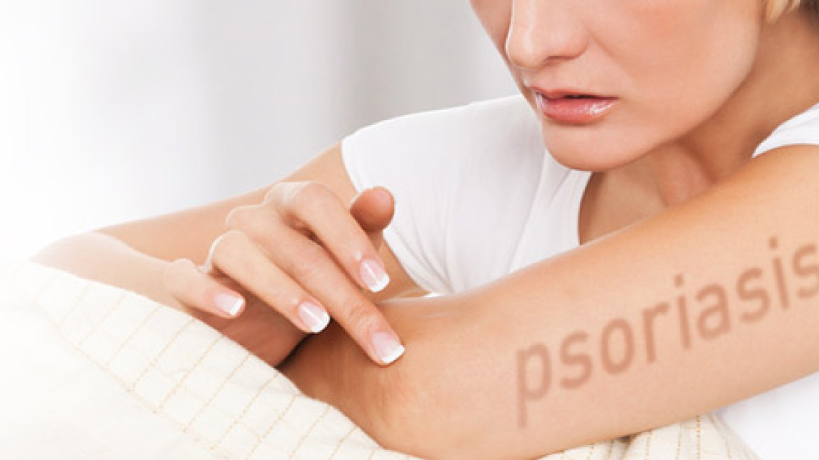 Ψωρίαση: Νέο φάρμακο υπόσχεται στους πάσχοντες καθαρό δέρμα