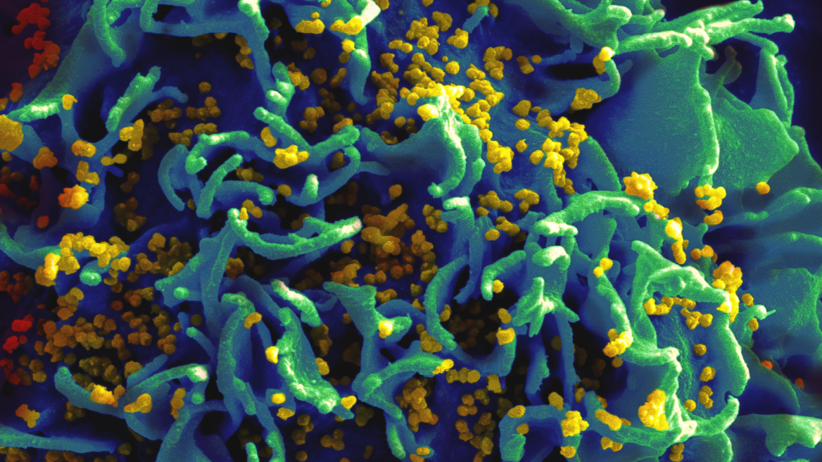 Γαλλία: Δύο φορείς του HIV «αυτο-θεραπεύτηκαν» από τον ιό 