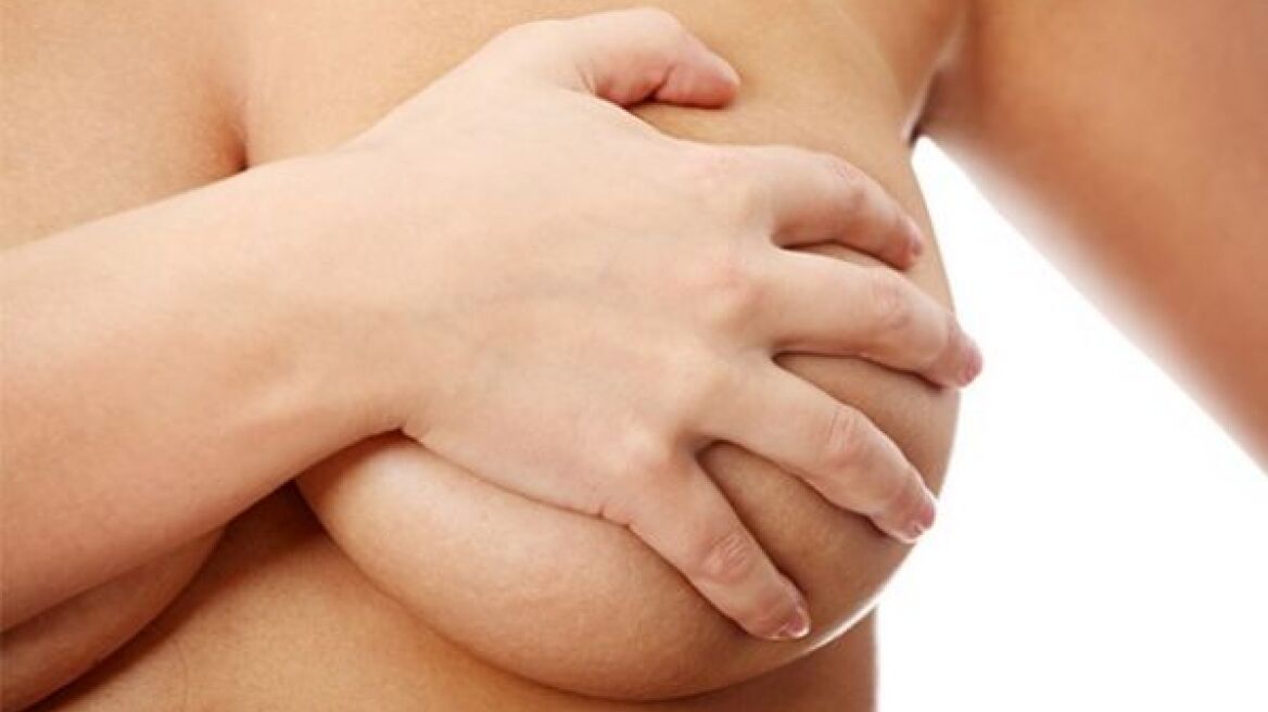 Θηλάζω και το στήθος μου είναι πολύ σκληρό. Τι να κάνω;