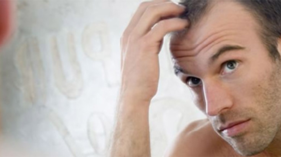 Τριχόπτωση: Βλαστοκύτταρα ή εμφύτευση μαλλιών;