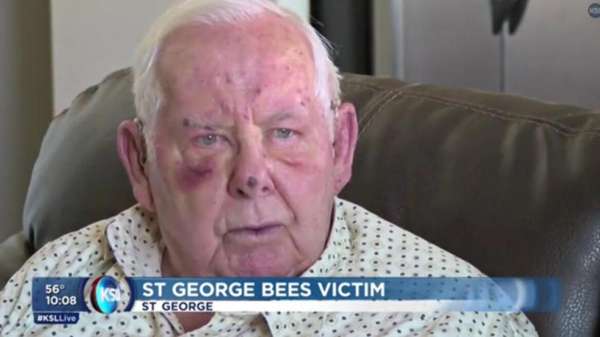 ΗΠΑ: Άνδρας δέχτηκε 400 τσιμπήματα από μέλισσες!