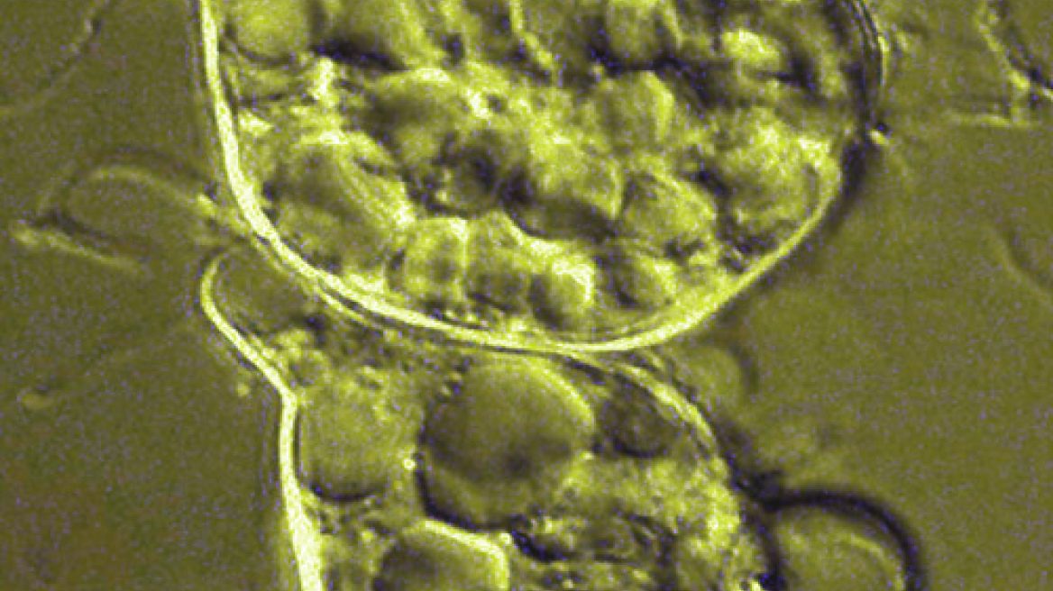 Ιωάννινα: Εντοπίστηκε επικίνδυνος για το οικοσύστημα μύκητας 