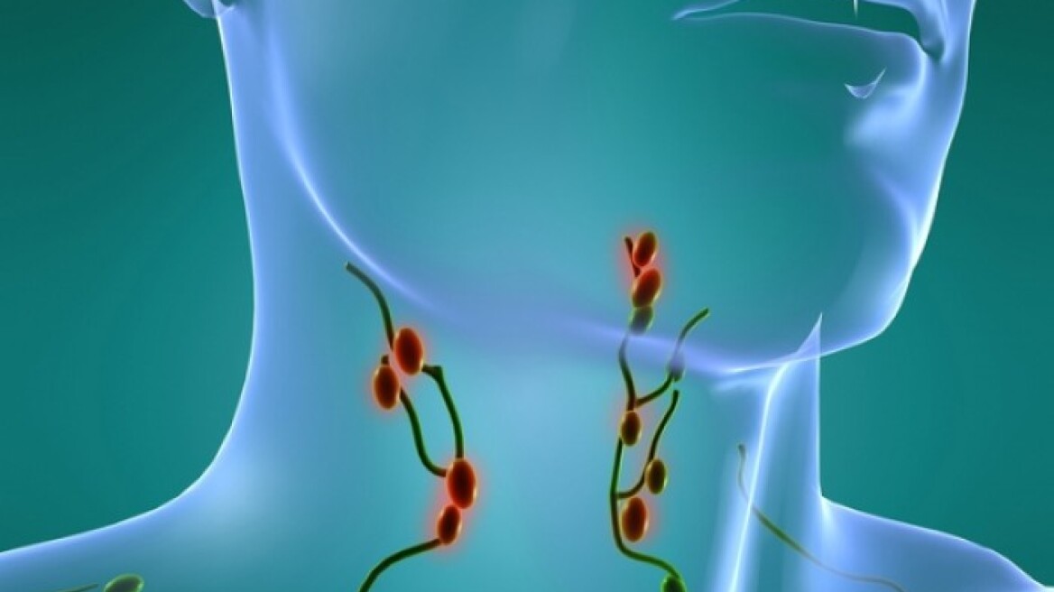 Καρκίνος στους λεμφαδένες: Αυτά είναι τα προειδοποιητικά σημάδια