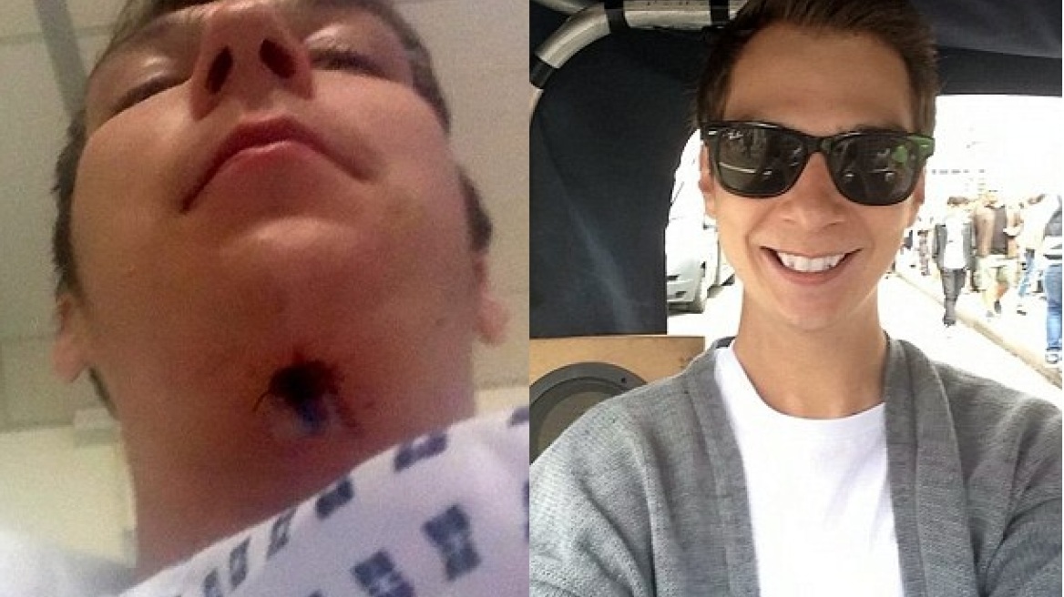 Απίστευτο: Ήθελε κάτασπρα δόντια και κατέληξε με... μια τρύπα στο λαιμό του