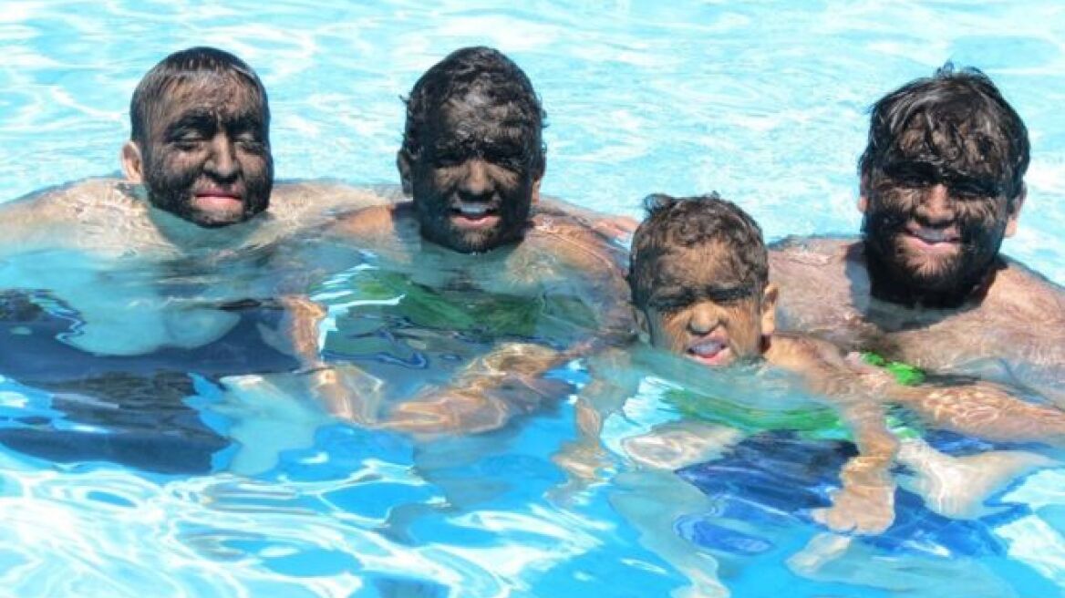 Μεξικό: Ντοκιμαντέρ για την πιο τριχωτή οικογένεια του κόσμου