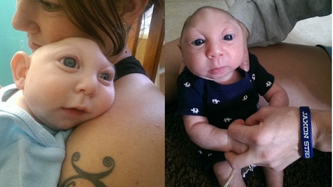 Μωρό με ανεγκεφαλία γιορτάζει τα πρώτα του γενέθλια διαψεύδοντας όλες τις προβλέψεις