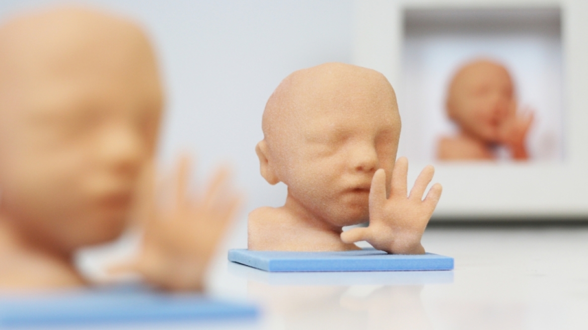 Πώς μπορείτε να εκτυπώσετε 3D το αγέννητο μωρό σας