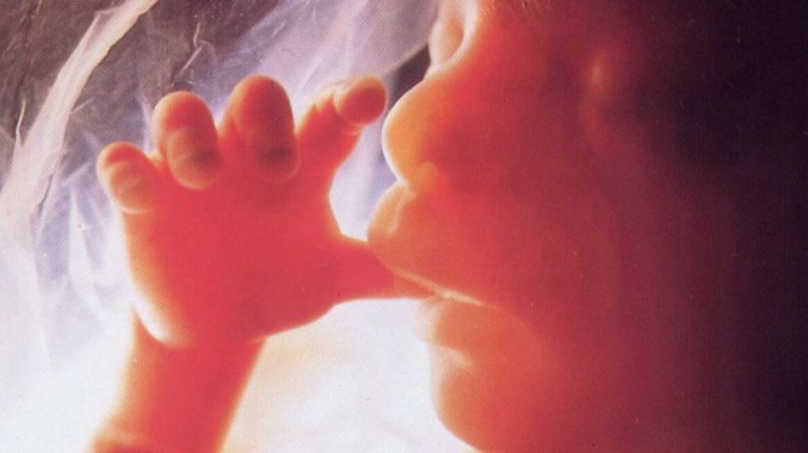 Greek abortions increase by 50% due to economic crisis