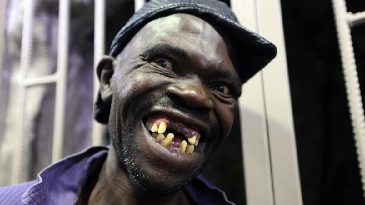 Ζιμπάμπουε: Σκάνδαλο στα καλλιστεία για τον «Mister Ugly» - Ο νικητής δεν είναι πολύ... άσχημος!