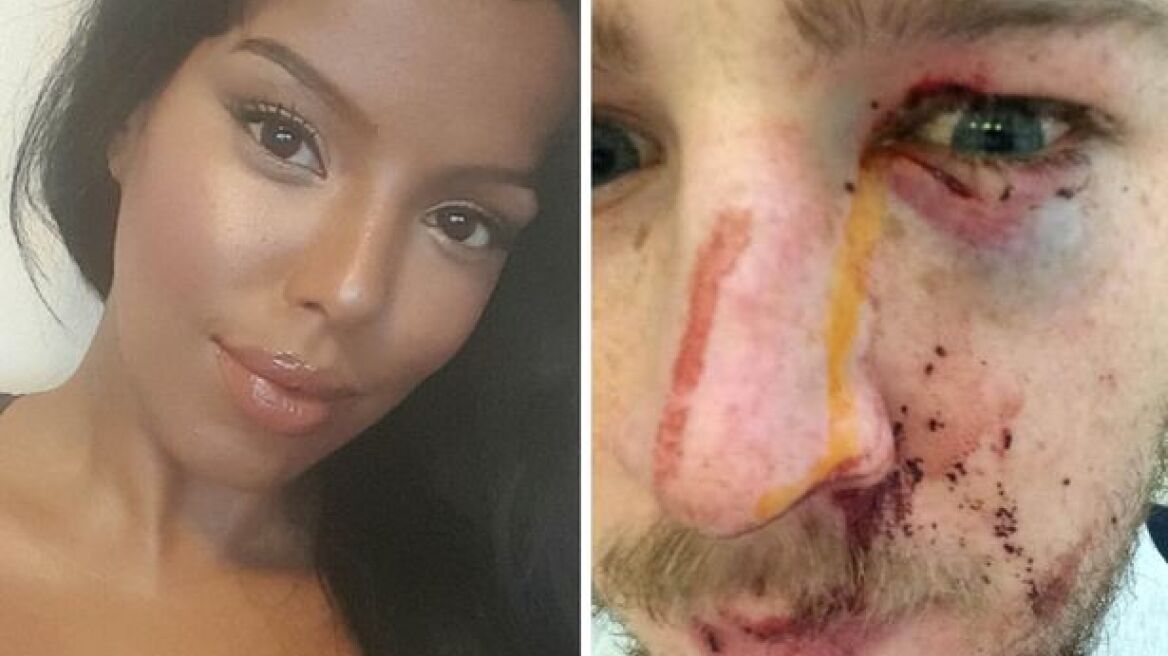 Student stabs man in the eye using her stiletto (pics+vid)