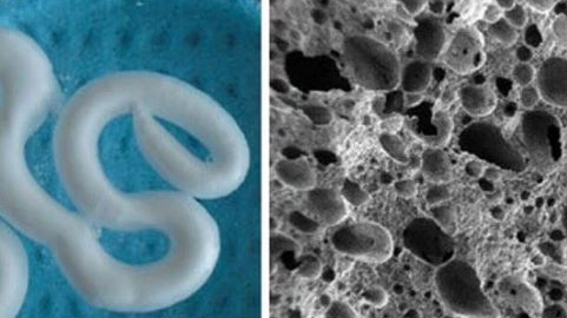 Επιστήμονες δημιούργησαν ενέσιμο αφρό που επιδιορθώνει εκφυλισμένα οστά