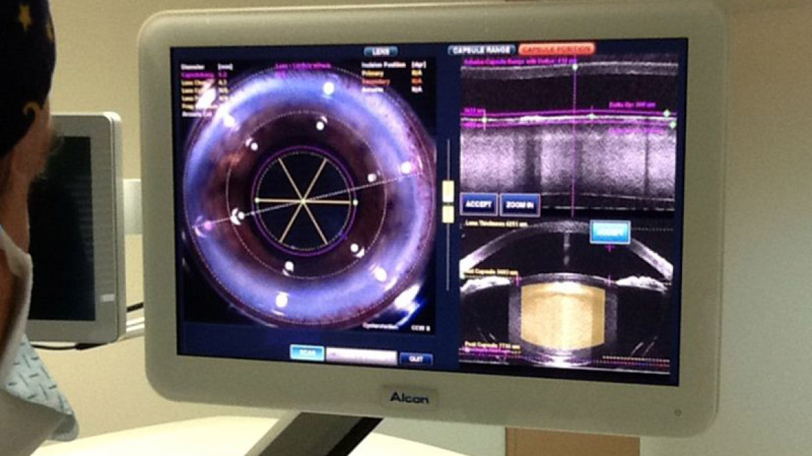 H πιο σύγχρονη μονάδα για laser χειρουργική καταρράκτη και διαθλαστική χειρουργική στο νοσοκομείο METROPOLITAN