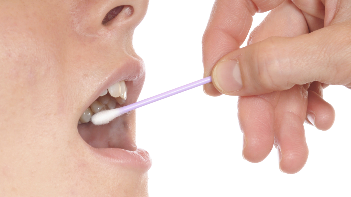 Πάμφθηνο τεστ σάλιου μπορεί να «βρει» αν ο χρήστης έχει καρκίνο σε δέκα λεπτά