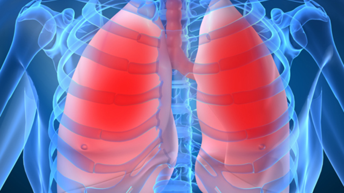 Μεγάλο κίνδυνο διατρέχουν 600.000 Έλληνες από «ΧΑΠ»: Τι προτείνουν στους πάσχοντες οι καλύτεροι πνευμονολόγοι