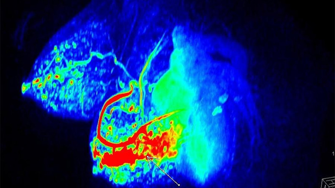 Προηγμένη Απεικόνιση με την Μαγνητική Τομογραφία στο Νοσοκομείο Μετροπόλιταν