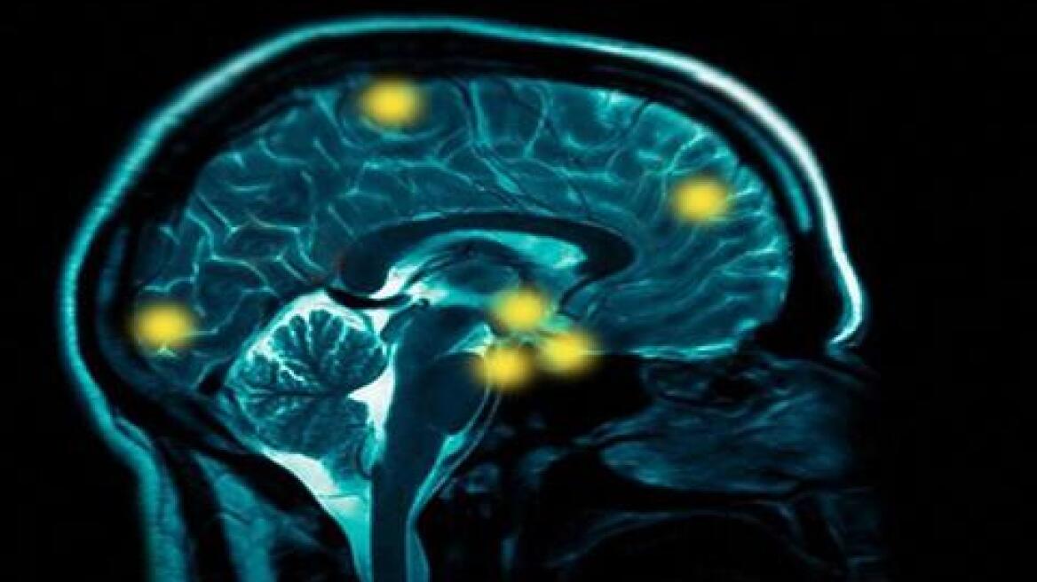 Πώς συνδέονται περιοδοντίτιδα και Αλτσχάιμερ