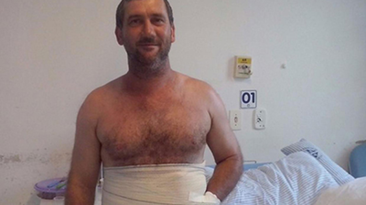 Doctors save man’s hand from amputation by burying in his belly (warning disturbing images)