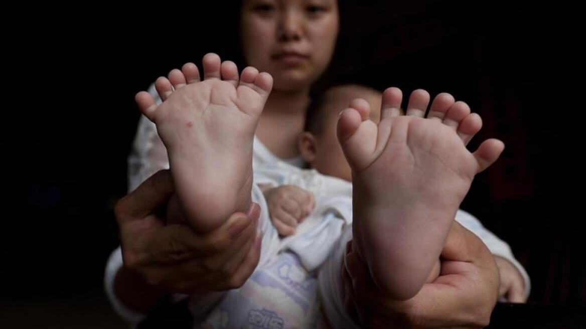 Aπίστευτο: Γεννήθηκε μωρό με 15 δάχτυλα στα χέρια και 16 στα πόδια