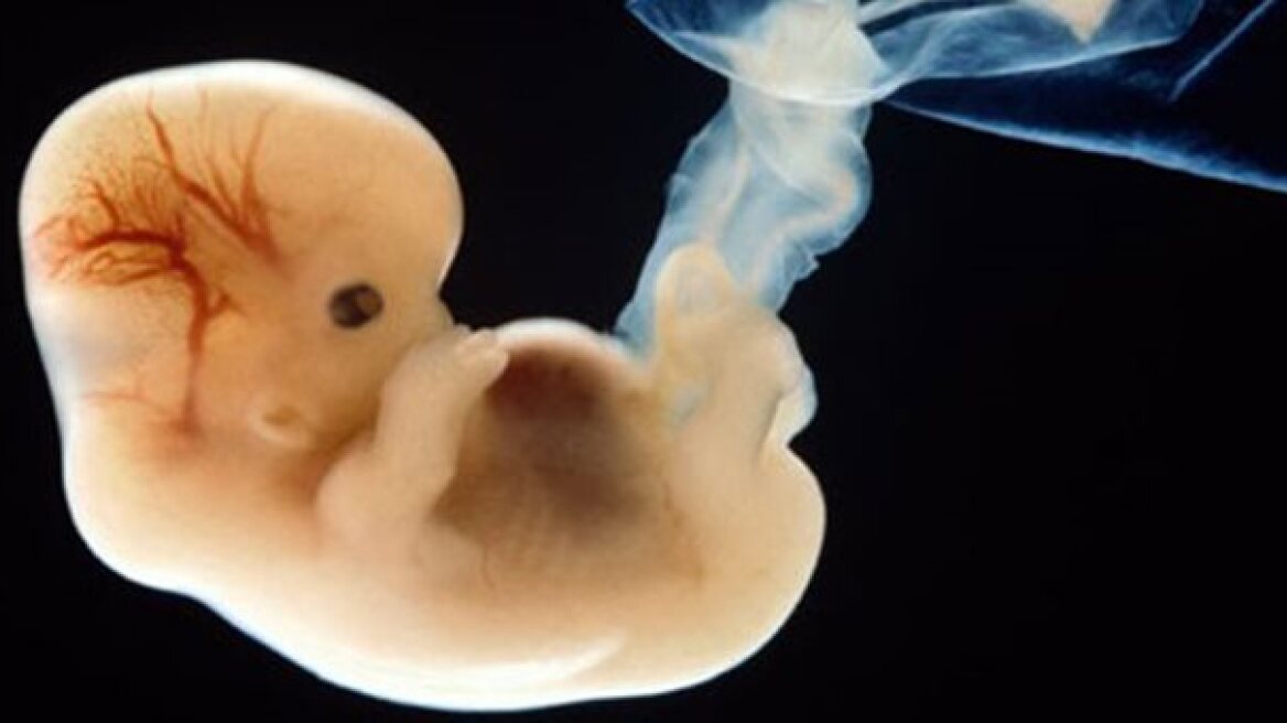 Εργαστηριακή καλλιέργεια ανθρωπίνου εμβρύου δύο εβδομάδων
