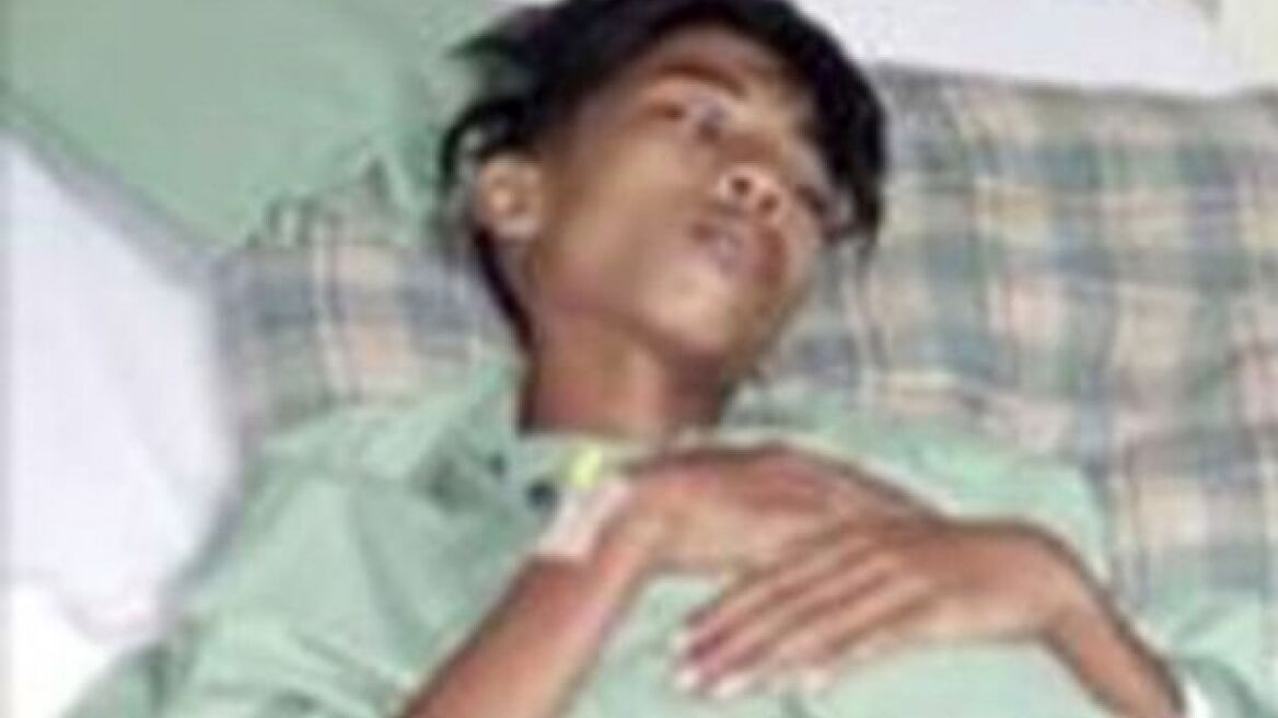 Shocking image: Boy had been carrying his mutant unborn twin for 15-years