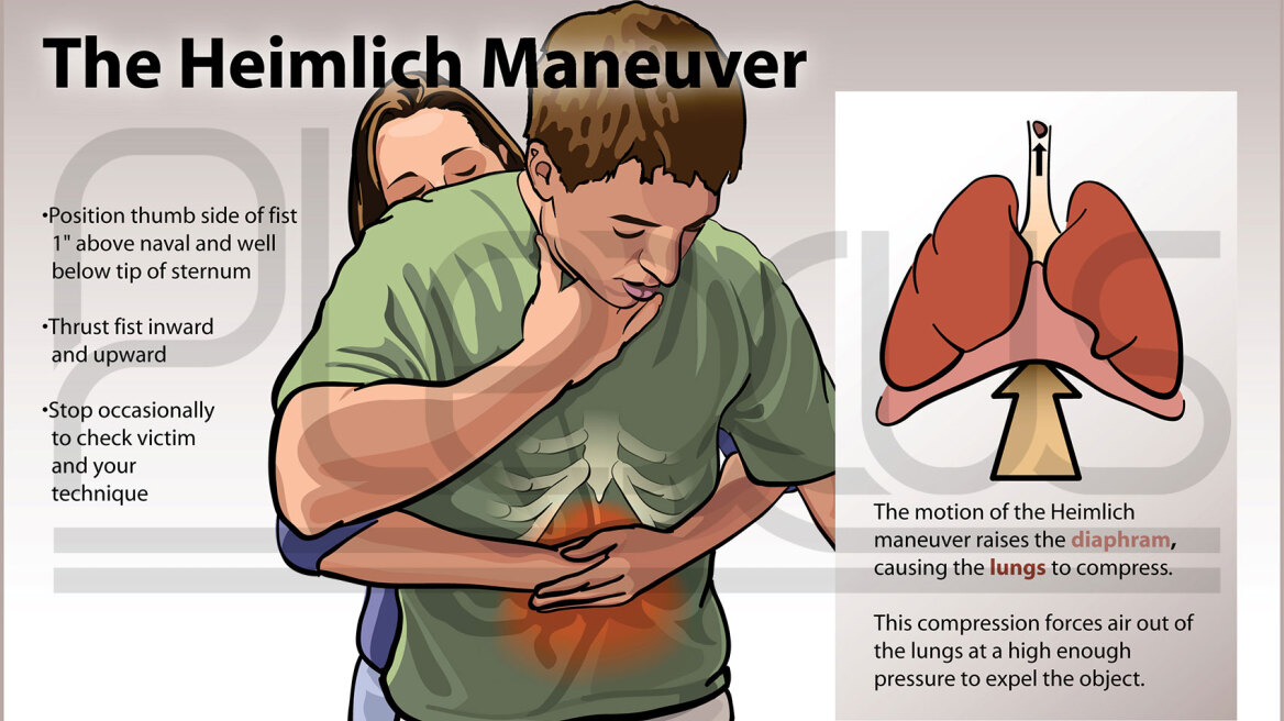 Ο Χένρι Χάιμλιχ έσωσε 87χρονη από πνιγμό χάρη στη... λαβή Χάιμλιχ!