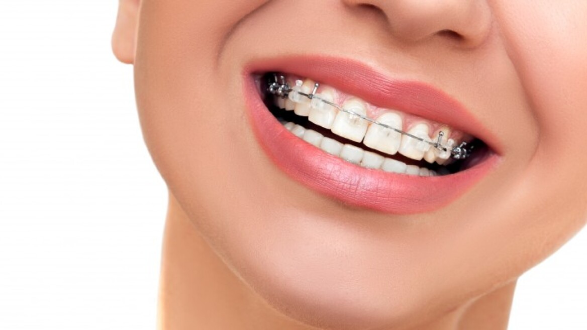 Τραυματισμοί των δοντιών: Ποιες είναι οι πρώτες βοήθειες;