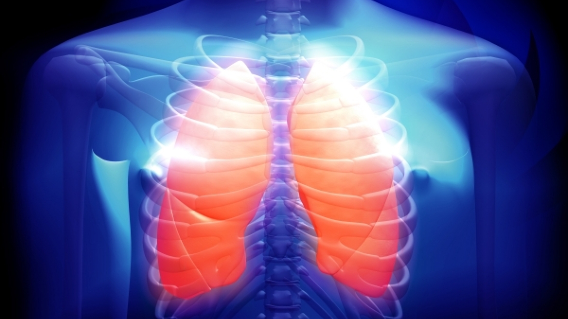 Κυστική Ίνωση: η θανατηφόρος νόσος που μετατρέπεται σταδιακά σε διαχειρίσιμη χρόνια πάθηση