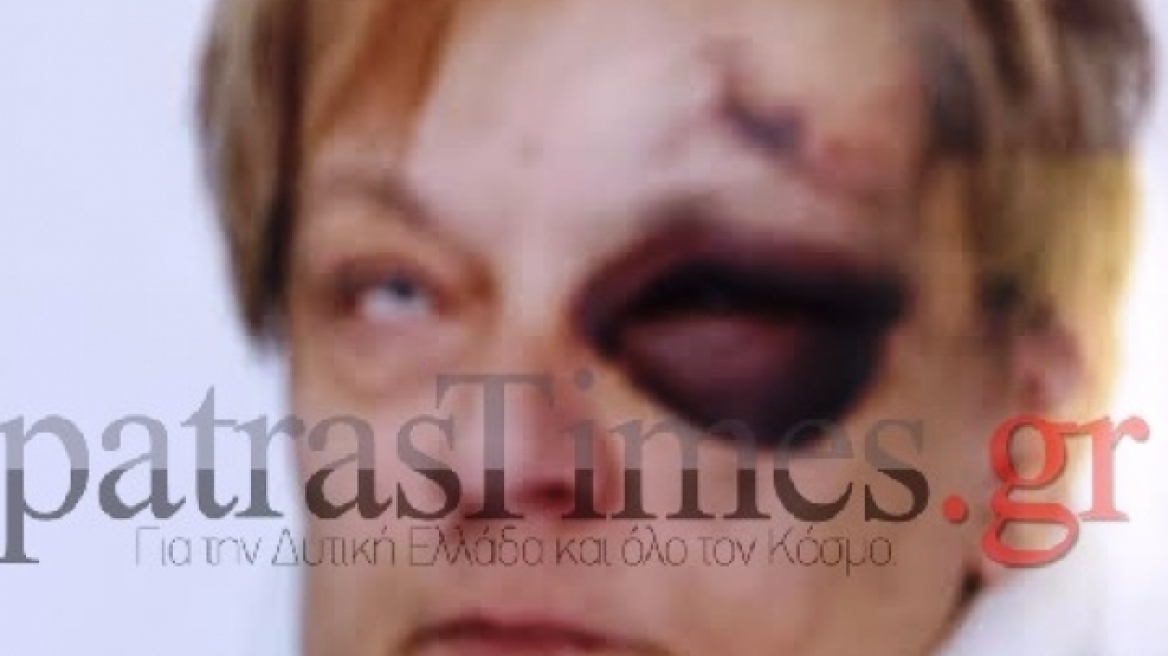 Πάτρα: Του ζήτησε τα νοίκια και την ξυλοκόπησε 